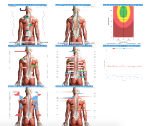 CLA insight scan results